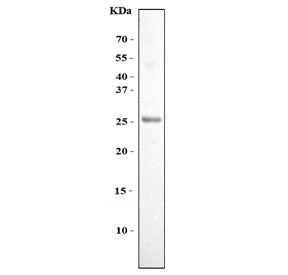 Western blot testing of human U-2 OS cell lysate with FGF11 antibody. Predicted molecular weight ~25