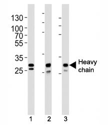 Cathepsin D Antibody (heavy chain)