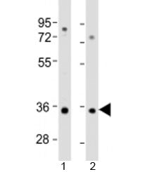 Western blot testing of human 1) A549 and 2) HT-1080 cell lysate with RSPO3 antibody at 1:2000. Pred