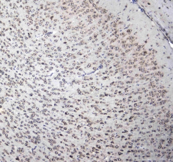 IHC testing of FFPE mouse brain tissue with L1CAM antibody at 1ug/ml. Required HIER: steam section i