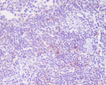 IHC staining of FFPE human tonsil tissue with CD25 antibody. HIER: boil tissue sections in pH6, 10mM