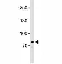 Western blot analysis of lysate from HeLa cell line using anti-PCSK9 antibody at 1:1000. Predicted s