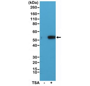 Western blot of extracts from human HeLa cells, untreated (-) or treated (+) with Trichostatin A (TS