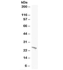Western blot testing of A431 lysate with BAK1 antibody at 0.5ug/ml. Predicted molecular weight: ~23k