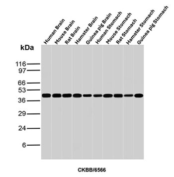 Western blot analysis of Human Brain, Mouse Brain, Rat Brain, Hamster Brain, Guinea pig Brain, Human