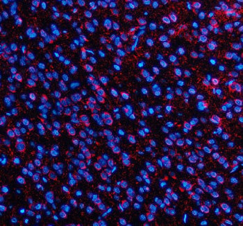 Immunofluorescent staining of SLC7A14 using anti-SLC7A14 antibody (red). SLC7A14 was detected in a p