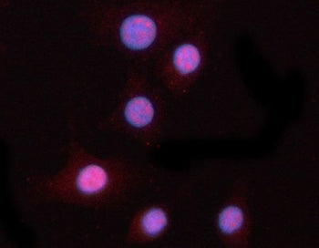 Immunofluorescent staining of FFPE human A549 cells with PPM1N antibody (red) and DAPI nuclear stain