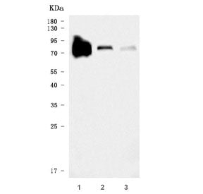 Transferrin Antibody / TF