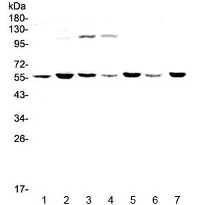 Western blot testing of human 1) HeLa, 2) MDA-MB-453, 3) Jurkat, 4) HepG2, 5) SK-OV-3, 6) PANC-1 and