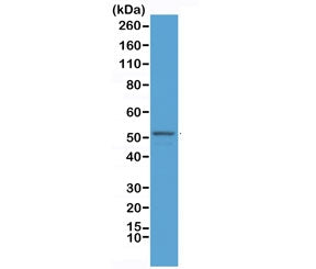 Western blot testing of mouse brain lysate with recombinant GFAP antibody at 1:2500. Predicted molec