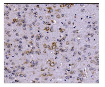 SCN1B Antibody