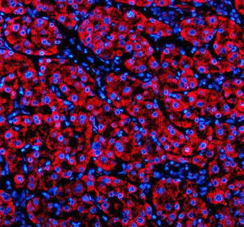 Immunofluorescent staining of SHD using anti-SHD antibody (red). SHD was detected in a paraffin-embe