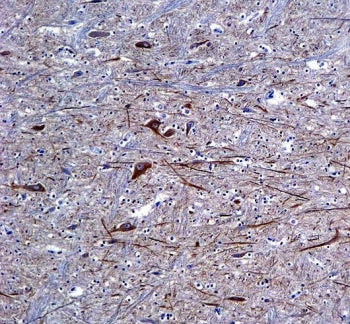 Alpha Internexin Antibody / INA / Neurofilament-66