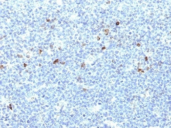 IHC: Formalin-fixed, paraffin-embedded human tonsil stained with HLA-Aw32 / HLA-A25 antibody (CATA-1