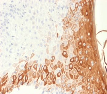 IHC testing of FFPE human skin with recombinant Keratin 10 antibody (clone rKRT10/1275). Required HI