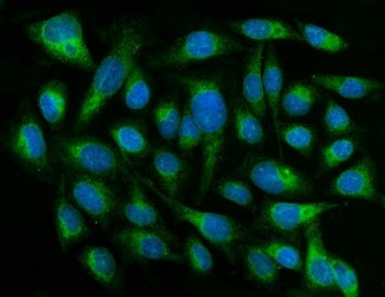 Immunofluorescent staining of FFPE human U-2 OS cells with CYB5R3 antibody (green) and DAPI nuclear 