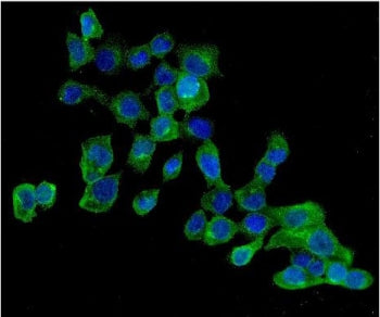 AMPK beta 2 Antibody / PRKAB2