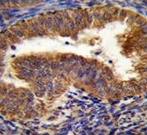 IHC testing of FFPE human uterus tissue with BNIP3L antibody. HIER: steam section in pH6 citrate buf