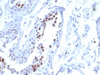 KIF2C Antibody / MCAK