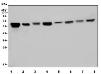 Western blot testing of human 1) HEK293, 2) ThP-1, 3) U-2 OS, 4) Jurkat, 5) rat PC-12, 6) mouse brai