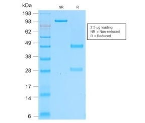 CD162 Antibody / P selectin glycoprotein ligand 1 / PSGL-1