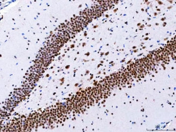 NCBP1 Antibody / CBP80