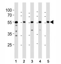 Western blot analysis of lysate from (1) A431, (2) RD, (3) mouse NIH3T3, (4) mouse C2C12, and (5) ra