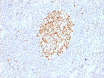 IHC staining of FFPE human lymph node with MSH6 antibody (clone MSH6/2927). HIER: boil tissue sectio