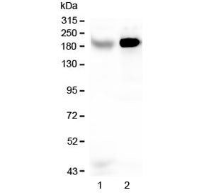 Western blot testing of human 1) Caco-2 and 2) HepG2 lysate with RRBP1 antibody at 0.5ug/ml. Expecte