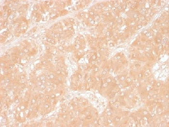 Adipophilin Antibody / Perilipin 2 / ADRP / PLIN2