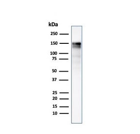 Western blot testing of A431 lysate using EGFR antibody (clone GFR/2341). Expected molecular weight: