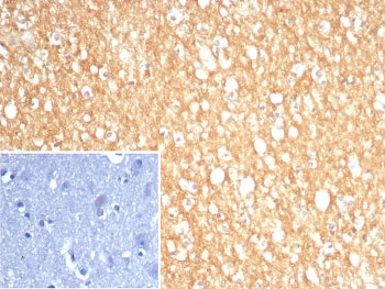 IHC staining of FFPE human brain tissue with S100A5 antibody (clone S100A5/7474). Inset: PBS used in