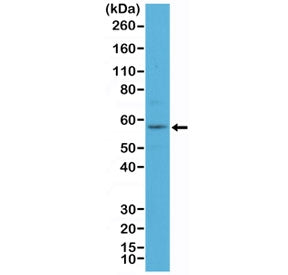 KRT4 Antibody / Cytokeratin 4