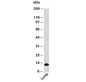 Western blot testing of human samples with S100A8 antibody (clone SA6279) at 2ug/ml. Predicted molec