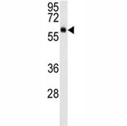 AKT3 Antibody, 0.4ml