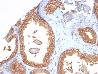 Recombinant Beta-2 Microglobulin Antibody