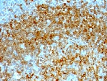 IHC testing of FFPE human tonsil with CD74 antibody (clone CDLA74-1). HIER: FFPE testing requires se