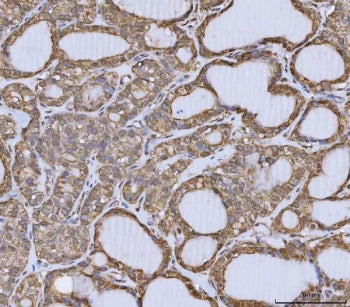 ANXA10 Antibody / Annexin A10