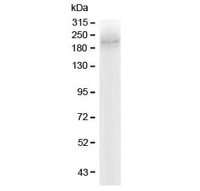 Western blot testing of human Caco-2 lysate with MRP2 antibody at 0.5ug/ml. Predicted molecular weig
