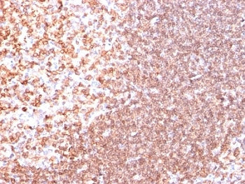 CD74 / CLIP Antibody