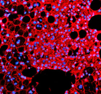 IHH Antibody / Indian hedgehog protein, 100ug