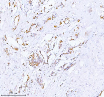 Immunohistochemical staining of PCYOX1 using anti-PCYOX1 antibody. PCYOX1 was detected in a paraffin