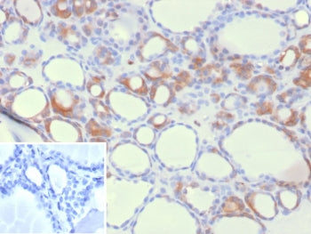 IHC staining of FFPE human thyroid tissue with HEG1 antibody (clone HEG1/9445). Inset: PBS used in p