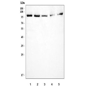 FER Antibody / Tyrosine-protein kinase Fer
