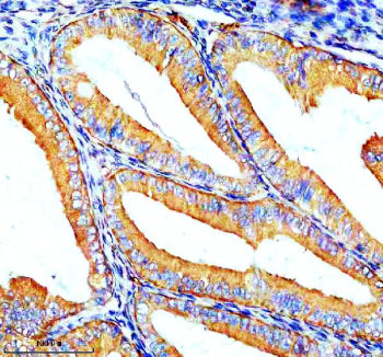 Immunohistochemical staining of ZIP8/SLC39A8 using anti-SLC39A8 antibody. ZIP8/SLC39A8 was detected 