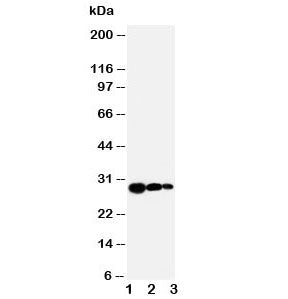 Western blot testing of TIMP1 antibody and Lane 1: recombinant human protein 10ng; 2: 5ng; 3. 2.5ng
