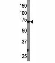 Western blot testing of APG7 antibody and mouse liver tissue lysate. Predicted molecular weight: 70-