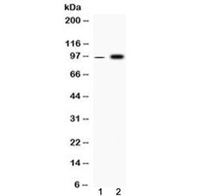 Fibrinogen alpha chain Antibody (FGA)