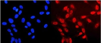 Immunofluorescent staining of FFPE human U-2 OS cells with Neurofibromin antibody (red) and DAPI nuc