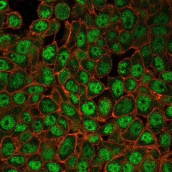 Immunofluorescent staining of PFA-fixed human HeLa cells with Upstream stimulatory factor 2 antibody